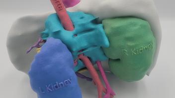 Colorful 3D anatomical model showing kidneys (blue, green), spine (cyan) and pink blood vessels