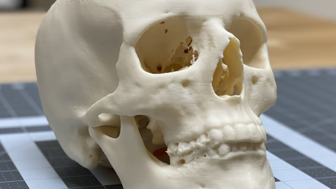 FDM 3D Printed Skull