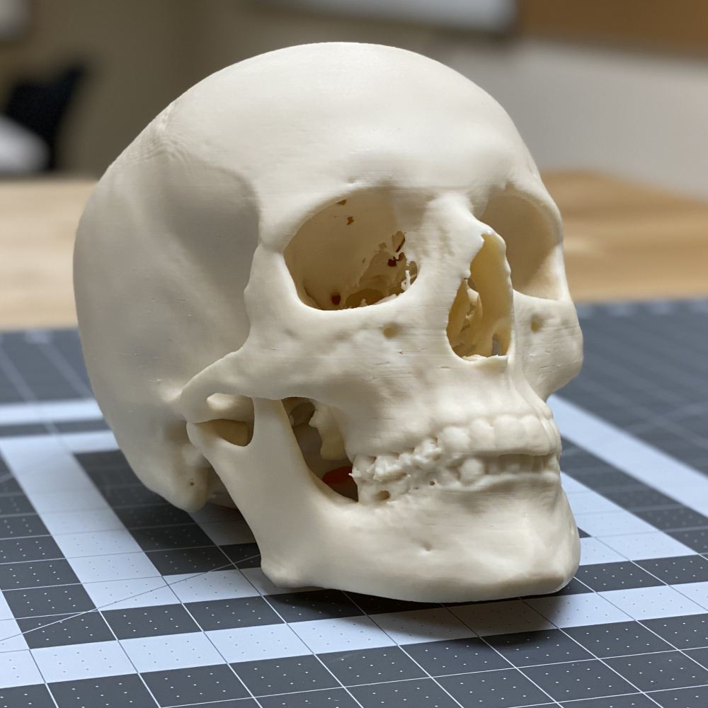 FDM 3D Printed Skull