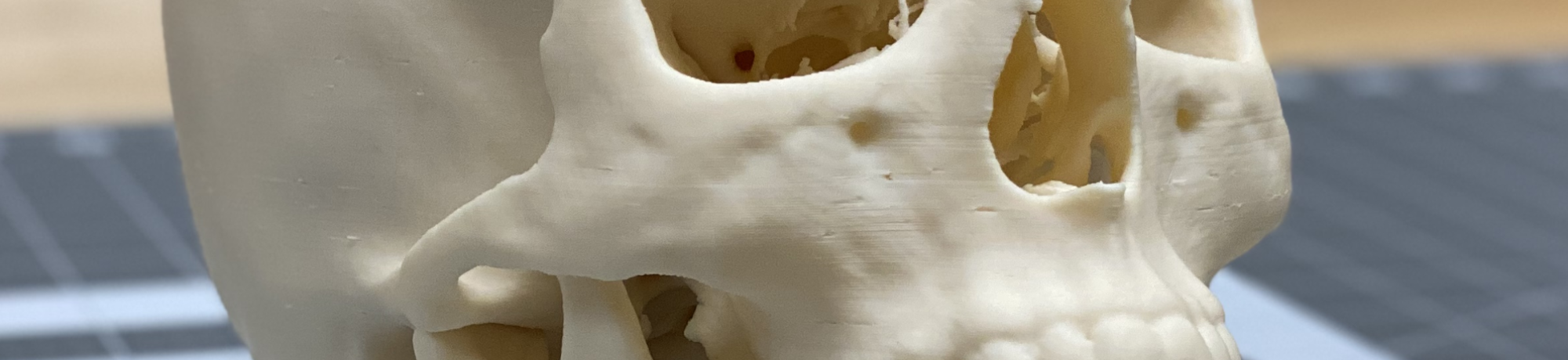FDM 3D Printed Skull
